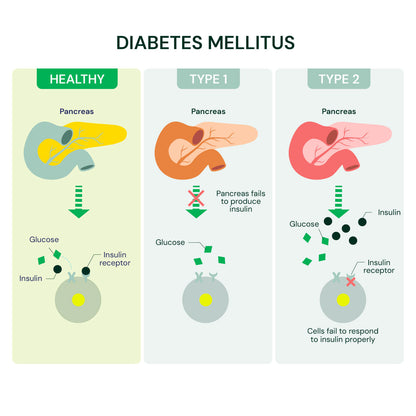 DNA Diabetes Risk Test