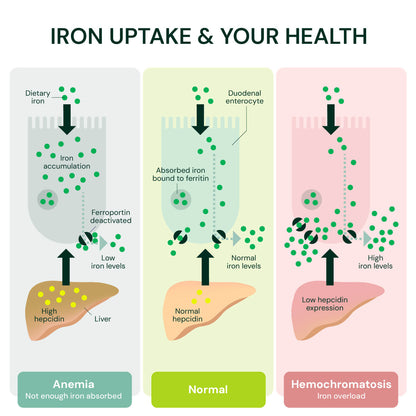 hemochromatosis and glutathione Dietary Sentinel Factors Leading to l-glutathione cancer treatment Role of